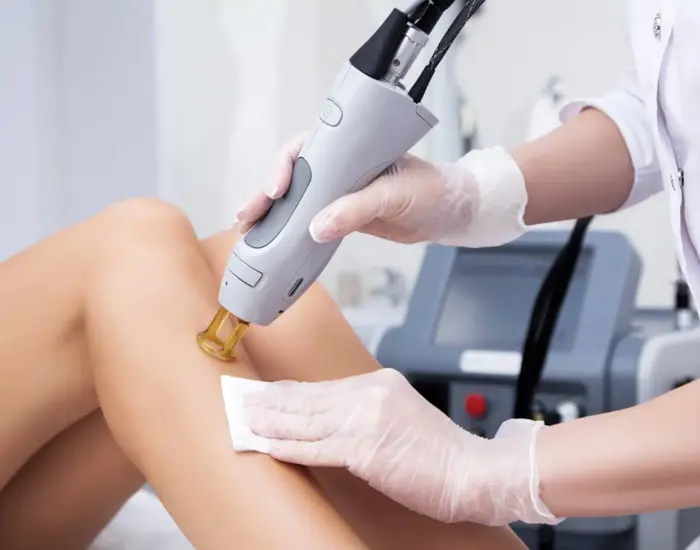 Sécurité et Efficacité : Les Réponses à Vos Questions sur l&rsquo;Épilation au Laser