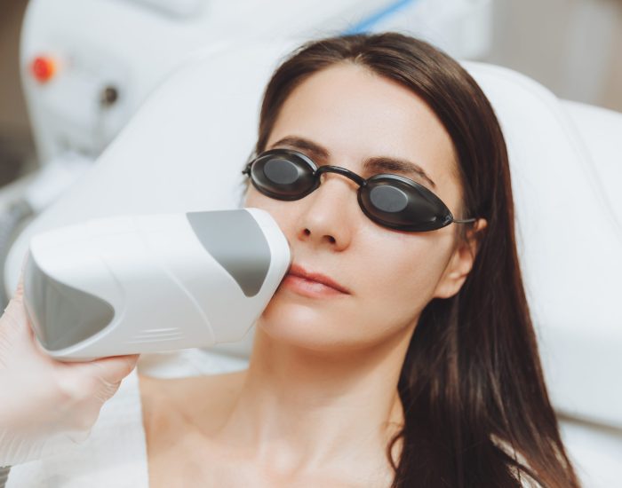 Épilation Définitive du Visage à Fès: Une Beauté Durable à Découvrir