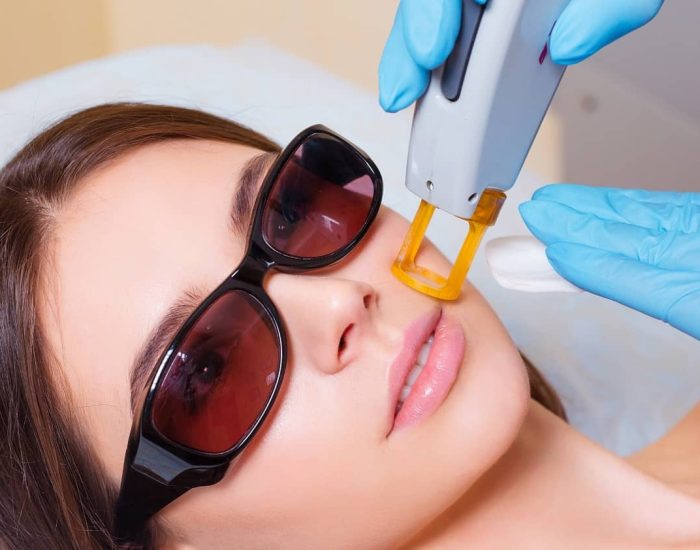 L&rsquo;épilation Laser du Corps Complet à Fès : epilateur laser poil visage