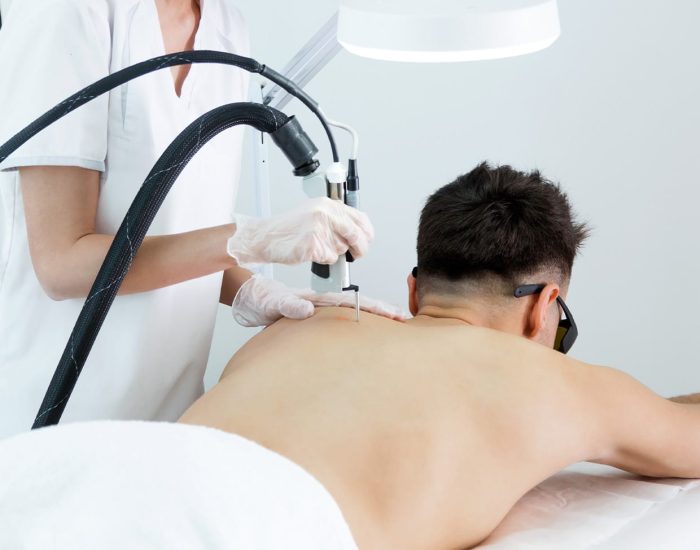 épilation définitive dos homme Fès : laser poil sur Centre épilation laser a fes (Pour raisons de maladies de la peau)