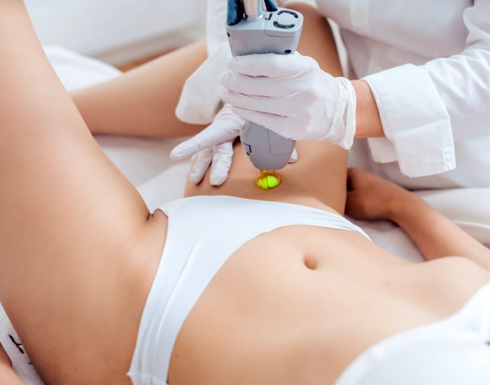 épilation définitive maillot à Fès : centre laser Fes arrazi pour épilation femmes