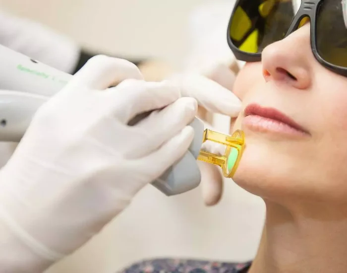 épilation laser visage fes : Centre ARRAZI epilation définitive indolore